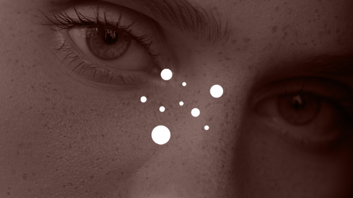 Beauty Marks